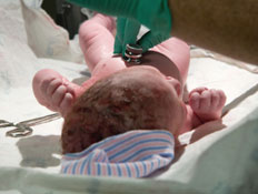ידי רופא בכפפות בודק בסטטוסקופ תינוק (צילום: Bryngelzon, Istock)