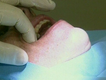 טיפול שיניים (תמונת AVI: חדשות1 ערוץ 2)