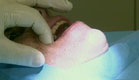 טיפול שיניים (תמונת AVI: חדשות1 ערוץ 2)