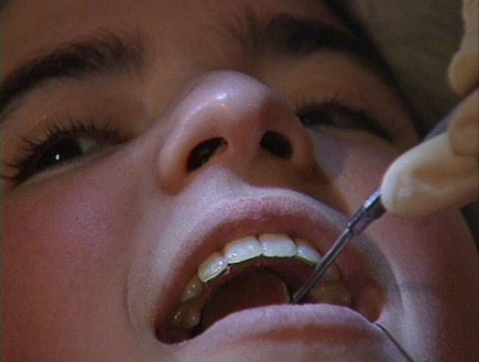 ילדה פותחת פה בטיפול אצל רופא שיניים (תמונת AVI: חדשות1 ערוץ 2)