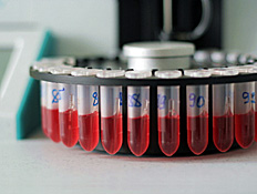 מבחנות דם במעבדה (צילום: Zoonar RF, Istock)