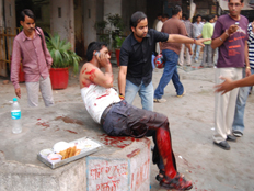 פצועים הודים בפיגוע (צילום: רויטרס)