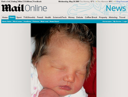 תינוקת עם פסים בשיער (צילום: מתוך אתר ה dailymail)