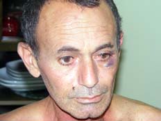 מישל לוגאסי, הותקף בידי שוטרים, מייל האדום (צילום: מיכה אטיאס)
