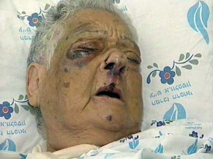 הקשישה שהותקפה בקניון (צילום: חדשות 2)