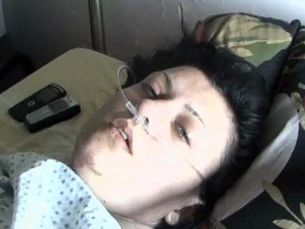 טקצ'נקו טטיאנה - נפלה לבור ונפצעה (צילום: חדשות 2)