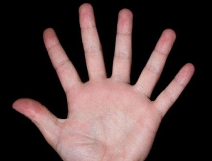 יד עם 6 אצבעות (צילום: istockphoto)