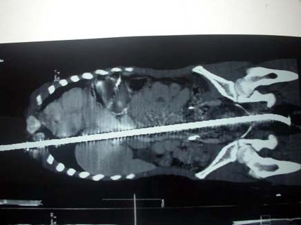 צילום רנטגן של קלים עלי כשמוט ברזל בגופו (צילום: Metro)