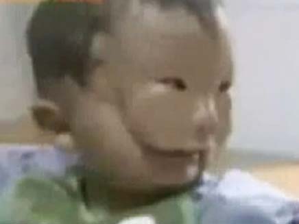 התינוק הסיני בעל פני המסכה (צילום: חדשות 2)