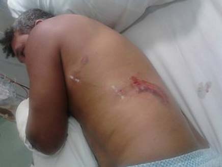 האב שהותקף בידי קרוקודיל (צילום: news.com)