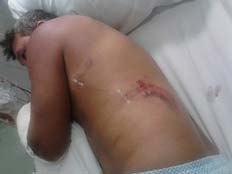 האב שהותקף בידי קרוקודיל (צילום: news.com)