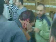 מפגין סורי פצוע בהפגנות בדרעא (צילום: חדשות 2)