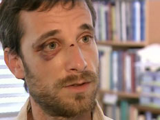 פעיל שמאל מציג את פציעתו (צילום: חדשות 2)