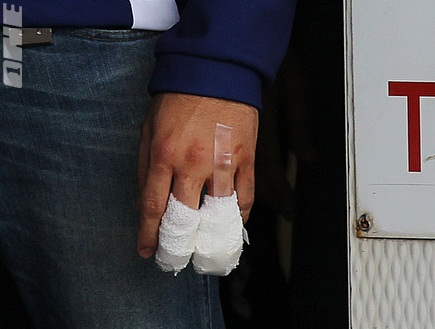 האצבע הפגועה של חורחה לורנסו (רויטרס) (צילום: מערכת ONE)