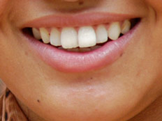 ממתיקים מלאכותיים מזיקים לשיניים (צילום: חדשות 2)