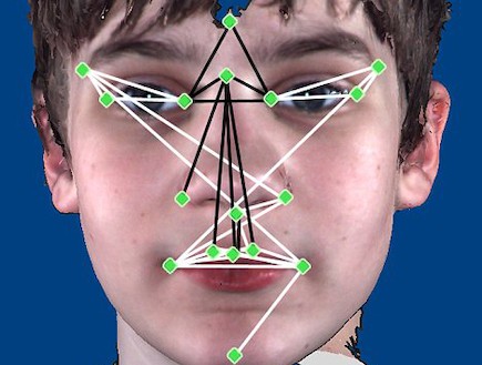 תווי פנים אוטיזם (צילום: צילום מסך)