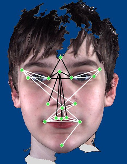 תווי פנים אוטיזם (צילום: צילום מסך)