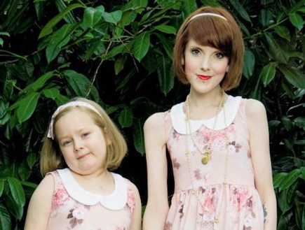 רבקה ג'ונס ובתה - אמא אנורקטית שוקלת יותר מבתה (צילום: MailOnline, Daily Mail)