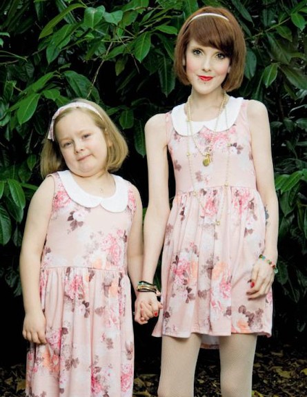 רבקה ג'ונס ובתה - אמא אנורקטית שוקלת יותר מבתה (צילום: MailOnline, Daily Mail)