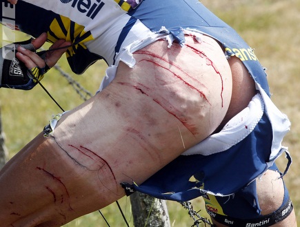 ג´וני הוגרלאנד ממשיך לרכוב למרות הפציעה ומדגים נחישות מה היא (רויט (צילום: מערכת ONE)