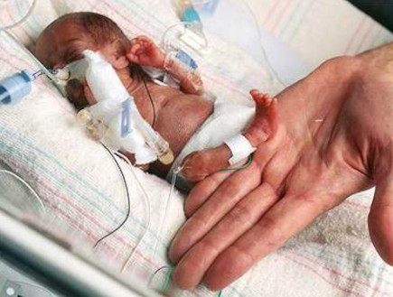 התינוקת הקטנה ביותר בעולם (צילום: צילום מסך מאתר The Sun Herald)