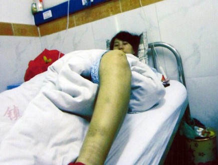 פנג ז'יאנגמיי - אולצה לעבור הפלה בחודש שביעי (צילום: dailymail.co.uk)