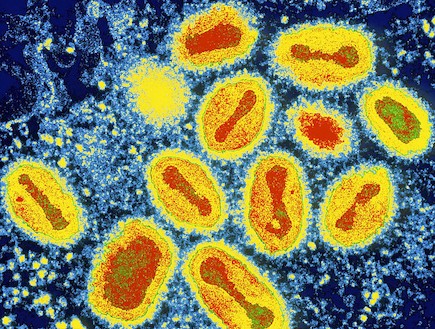 וירוסים וחיידקים בהגדלה (צילום: dailymail.co.uk)