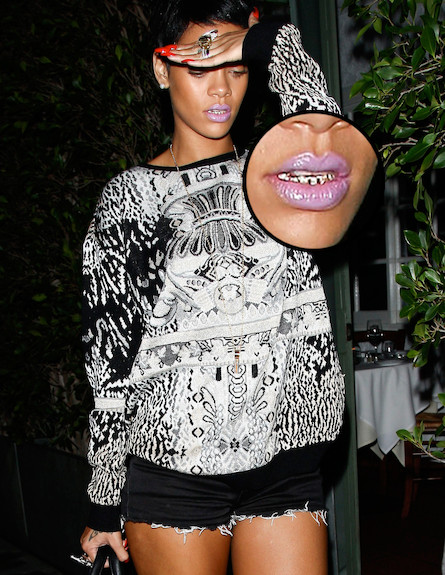 שיני הזהב של ריהאנה (צילום: SWAP / Splash News, Splash news)