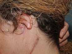 האישה שמגלדת אוזן ביד (צילום: dailymail.co.uk)