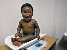 למטה תינוק במרפאת האיידס (צילום: משה שי לפלאש 90, גלובס)