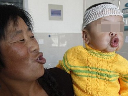 יוצ'ין צ'יאולי התינוקת שנראית כמו זקנה (צילום: dailymail.co.uk)