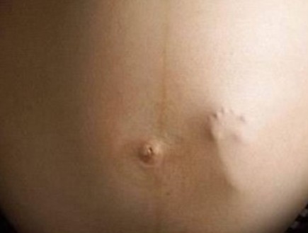 כף רגל בבטן הריונית - תמונות הריון מוזרות (צילום: צילום מתוך אתר The stir)