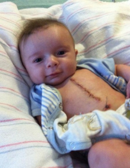 ג'ואי פאולינג, התינוק המנותח החתיך בצורה מגוחכת (צילום: צילום מסך מתוך www.reddit.com)