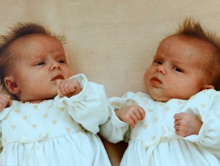 קרול הורלוק - תאומים בפונדקאות (צילום: צילום מסך daily mail)