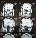 מוח (צילום: realsimple.com)