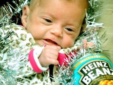 התינוקת ששוקלת פחות מפחית שימורים (צילום: צילום מסך daily mail)