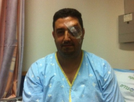 אלי כהן, שוטר שהותקף (צילום:  שמעון איפרגן)