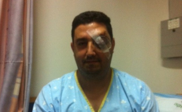 אלי כהן, שוטר שהותקף (צילום:  שמעון איפרגן)