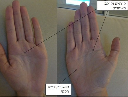 כף היד של רואית (צילום: תומר ושחר צלמים, צילום ביתי)