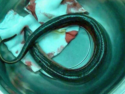 צלופח נתקע בבטן (צילום: huffingtonpost.com)
