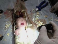 תינוק שהוצא מהביוב (צילום: צילום מסך daily mail)