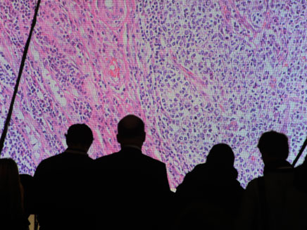 תאי סרטן בהגדלה (צילום: רויטרס)