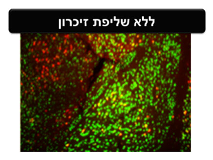 תאי עצב ללא שליפת זיכרון (צילום: אוניברסיטת תל אביב)