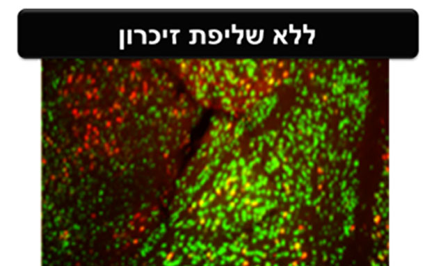 תאי עצב ללא שליפת זיכרון (צילום: אוניברסיטת תל אביב)
