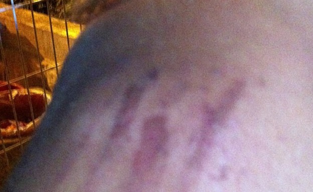 כרמן אלמקייס עמוס נפצעה בהפגנה