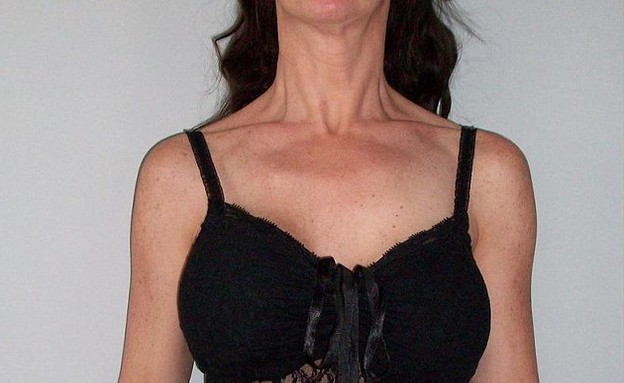 הלבשה תחתונה - לנג'רי לכרותות שד (צילום: dailymail.co.uk)