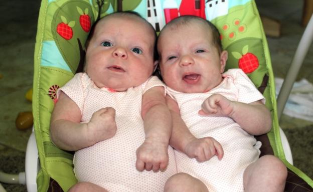 התאומות הדלי והיילי לארקין (צילום: nydailynews.com)