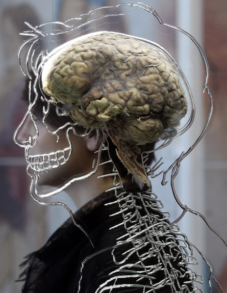 מוח (צילום: Matt Cardy, GettyImages IL)