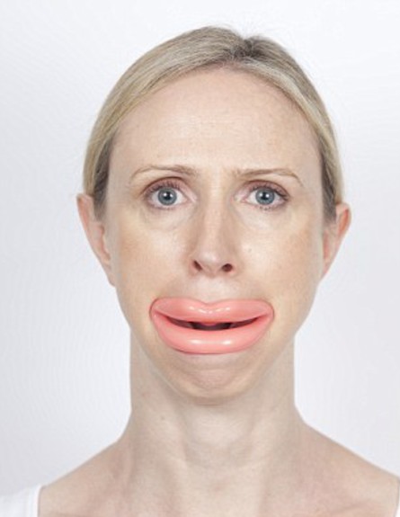 מתקן שפתיים (צילום: dailymail.co.uk)