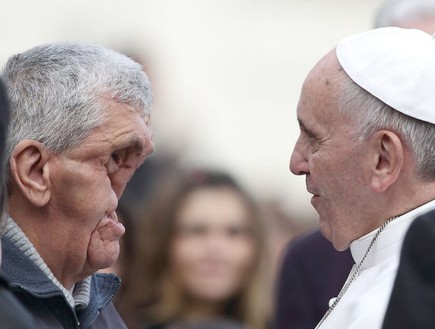 האפיפיור והאדם חצוי הפנים (צילום: dailymail.co.uk)